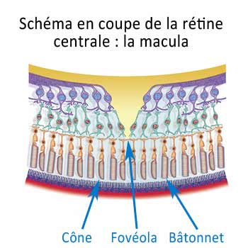 schema-coupe-macula_1_1