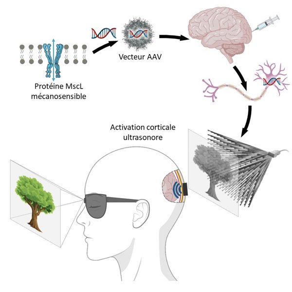 projet-sound-vision-guide-vue-therapie-sonogenetique-c-alexandre-dizeux-physics-for-medicine-paris