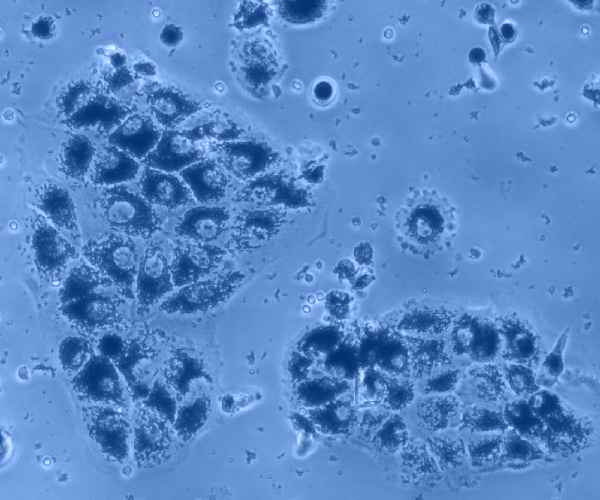 Cellules cultivées in vitro et observées au microscope à contraste de phase 