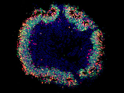 Organoïde rétinien en imagerie de fluorescence. ©Institut de la Vision