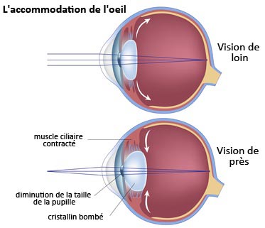 Schéma sur l'accommodation de l'œil