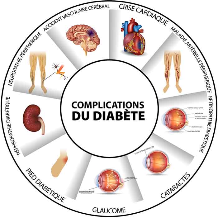 conséquence diabète santé corps