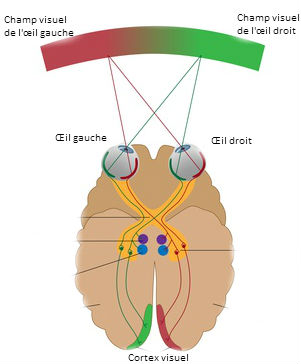 schéma oeil strabisme champ visuel